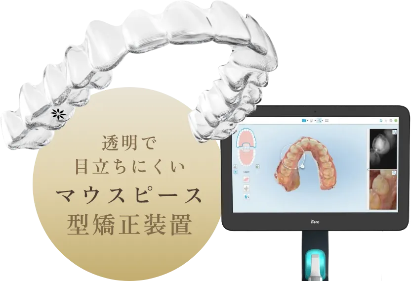 錦糸町の歯医者・歯科|ホワイトデンタルクリニック錦糸町の透明で目立ちにくいマウスピース型矯正装置