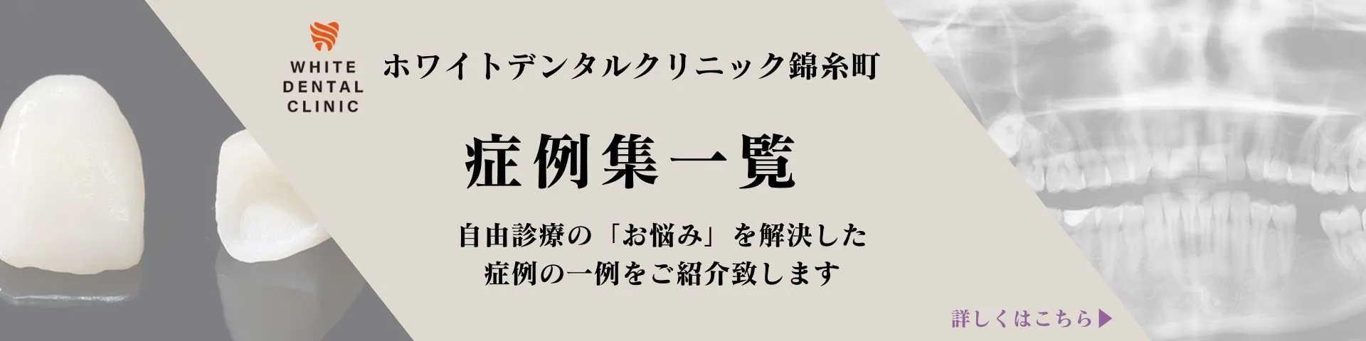 錦糸町の歯医者・歯科|ホワイトデンタルニック錦糸町の症例