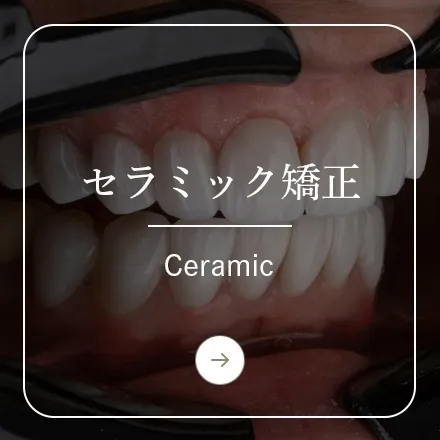 錦糸町の歯医者・歯科|ホワイトデンタルクリニック錦糸町のセラミック矯正