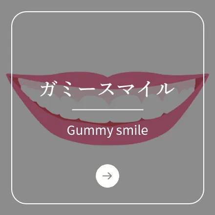 錦糸町の歯医者・歯科|ホワイトデンタルクリニック錦糸町のガミースマイル