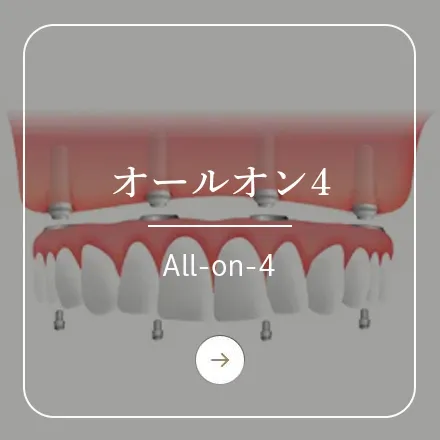 錦糸町の歯医者・歯科|ホワイトデンタルクリニック錦糸町のオールオン4
